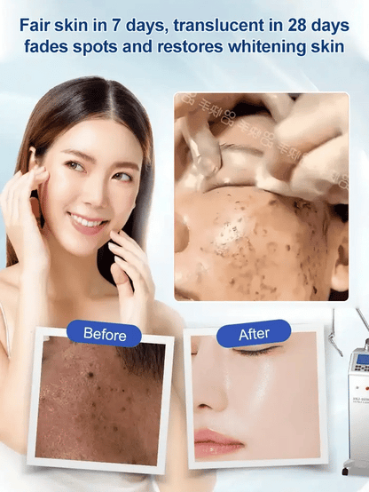 Korean Vitamin E Urea Cream 100g (BUY 1 GET 1 FREE)