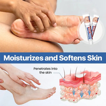 Cvreoz® SugarGuard Healing Cream