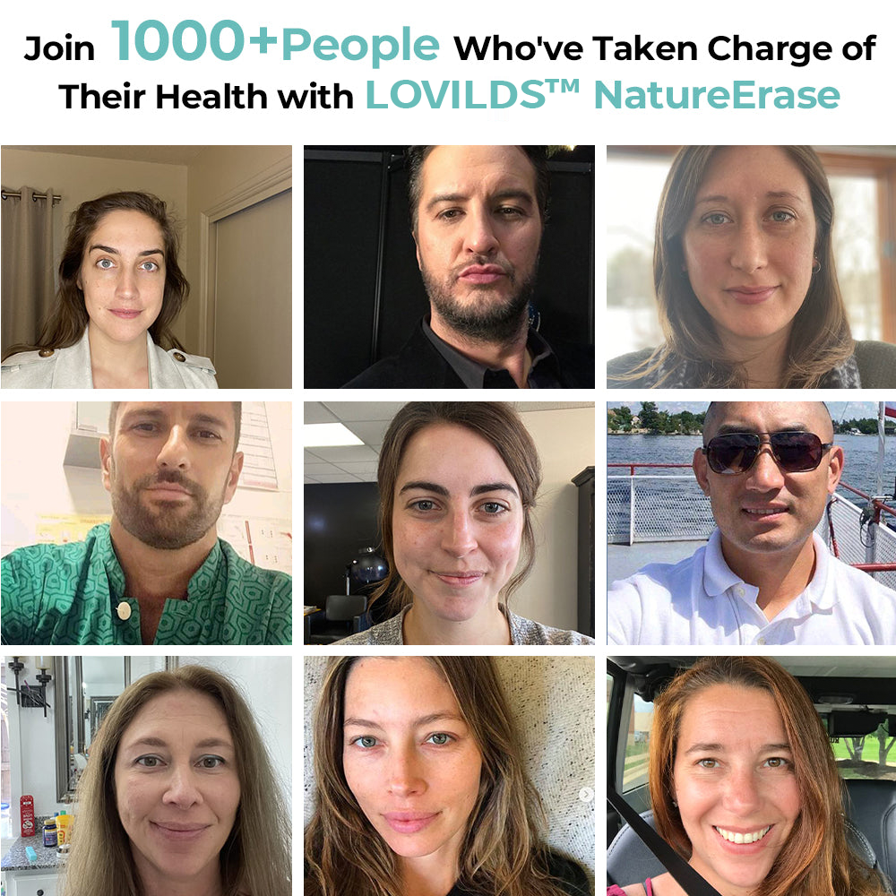 LOVILDS™ NatureErase Instant Mole & Spot Removal Gel