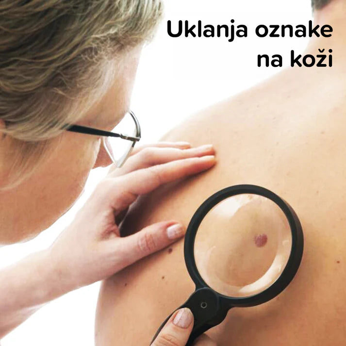 Premium Cream for dead skin, spots and warts